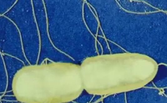 salmonelles, salmonelloses