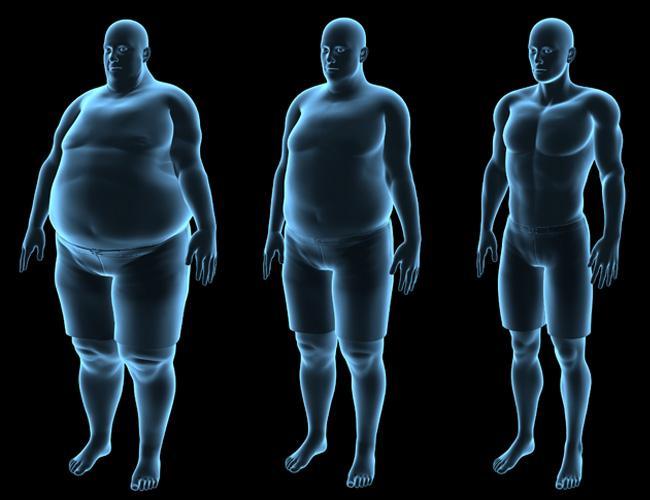 microbiote obésité