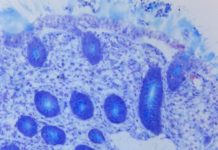 microbiote microplastiques