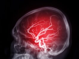 Hexane, le neurotoxique tueur de cerveau Hexane neurotoxique
