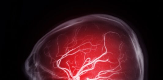 Hexane, le neurotoxique tueur de cerveau Hexane neurotoxique