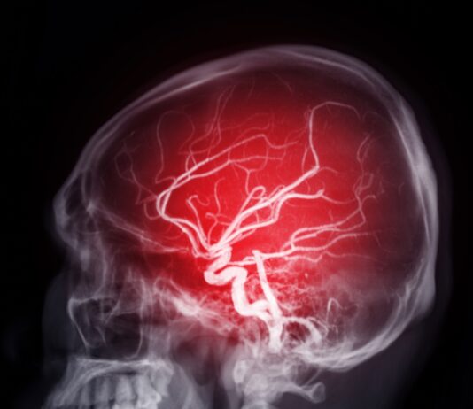 Hexane, le neurotoxique tueur de cerveau Hexane neurotoxique