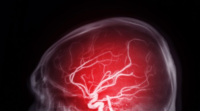 Hexane, le neurotoxique tueur de cerveau Hexane neurotoxique